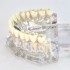  Анатомическая модель зубных патологий ( 9х6х7см)